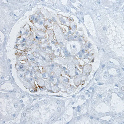 Immunohistochemistry (Formalin/PFA-fixed paraffin-embedded sections) - Anti-PLA2R antibody [CL0474] (AB188028)