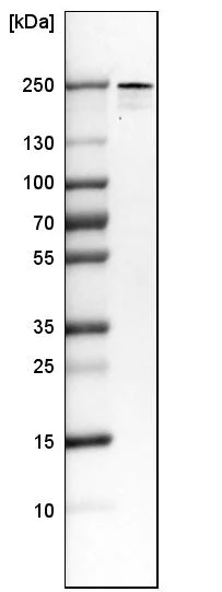 Western blot - Anti-PLA2R antibody [CL0474] (AB188028)