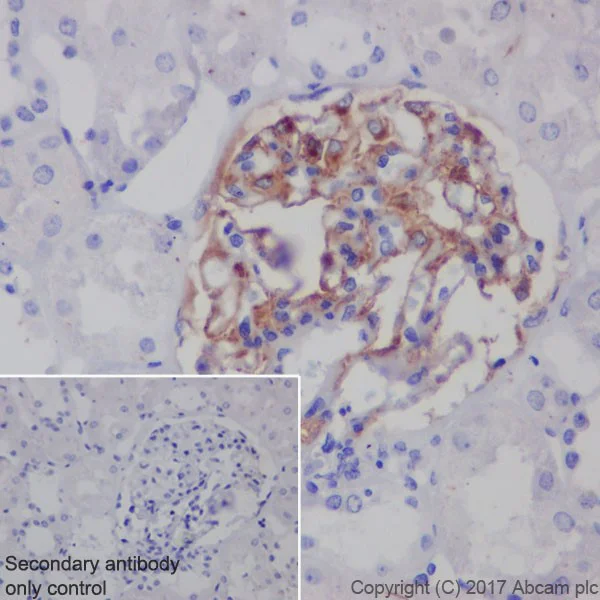 Immunohistochemistry (Formalin/PFA-fixed paraffin-embedded sections) - Anti-PLA2R antibody [EPR20483] (AB211573)