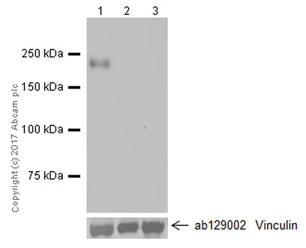Western blot - Anti-PLA2R antibody [EPR20483] (AB211573)