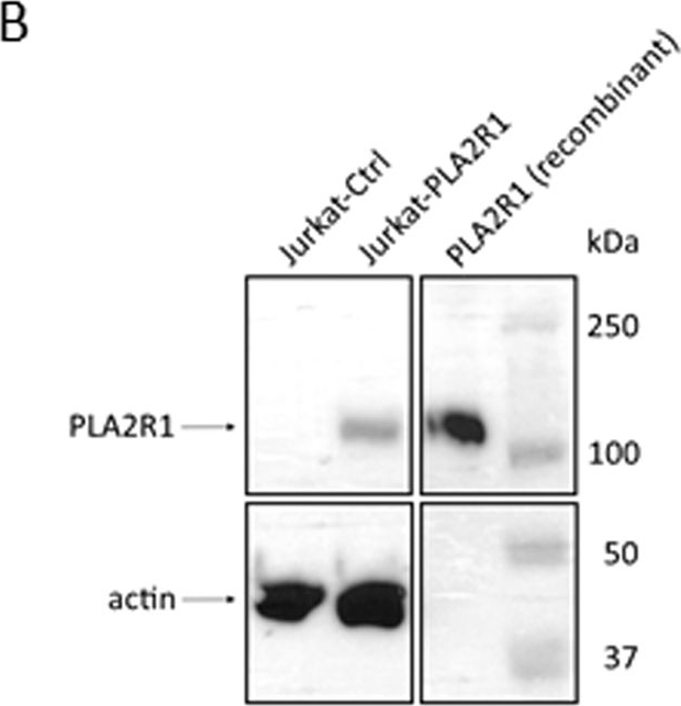 Western blot - Anti-PLA2R antibody [EPR20483] (AB211573), expandable thumbnail