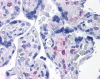 Immunohistochemistry (Formalin/PFA-fixed paraffin-embedded sections) - Anti-PLAC1 antibody (AB117528)