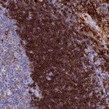 Immunohistochemistry (Formalin/PFA-fixed paraffin-embedded sections) - Anti-PLAC8 antibody (AB122652)