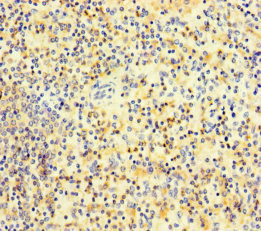 Immunohistochemistry (Formalin/PFA-fixed paraffin-embedded sections) - Anti-PLAC8 antibody (AB234788), expandable thumbnail