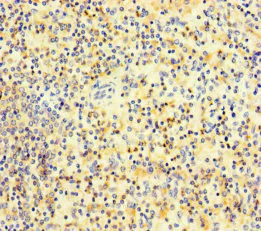 Immunohistochemistry (Formalin/PFA-fixed paraffin-embedded sections) - Anti-PLAC8 antibody (AB234788)