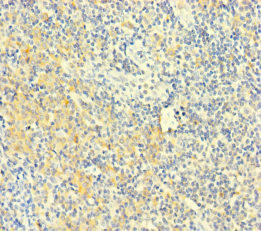 Immunohistochemistry (Formalin/PFA-fixed paraffin-embedded sections) - Anti-PLAC8 antibody (AB234788), expandable thumbnail