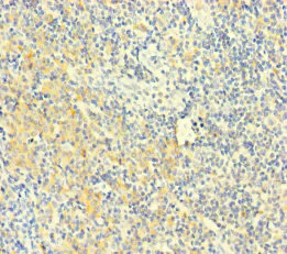 Immunohistochemistry (Formalin/PFA-fixed paraffin-embedded sections) - Anti-PLAC8 antibody (AB234788)