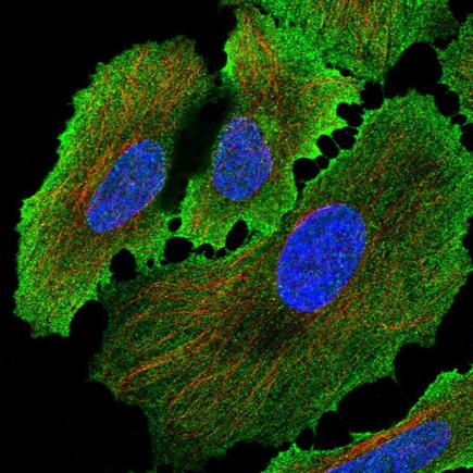Immunocytochemistry/ Immunofluorescence - Anti-Placental alkaline phosphatase (PLAP) antibody (AB243731), expandable thumbnail