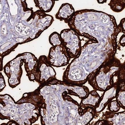 Immunohistochemistry (Formalin/PFA-fixed paraffin-embedded sections) - Anti-Placental alkaline phosphatase (PLAP) antibody (AB243731), expandable thumbnail
