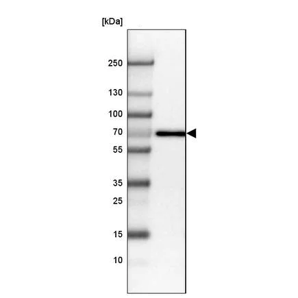 Western blot - Anti-Placental alkaline phosphatase (PLAP) antibody (AB243731)