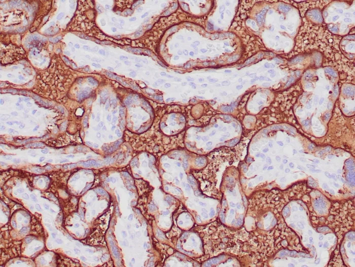 Immunohistochemistry (Formalin/PFA-fixed paraffin-embedded sections) - Anti-Placental alkaline phosphatase (PLAP) antibody [ALPP/870] (AB216038)