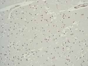 Immunohistochemistry (Formalin/PFA-fixed paraffin-embedded sections) - Anti-Placental alkaline phosphatase (PLAP) antibody [EPR6141] (ab133602), expandable thumbnail