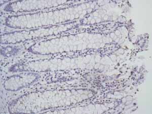 Immunohistochemistry (Formalin/PFA-fixed paraffin-embedded sections) - Anti-Placental alkaline phosphatase (PLAP) antibody [EPR6141] (ab133602), expandable thumbnail