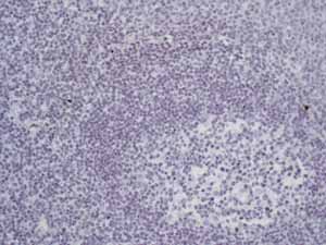 Immunohistochemistry (Formalin/PFA-fixed paraffin-embedded sections) - Anti-Placental alkaline phosphatase (PLAP) antibody [EPR6141] (ab133602), expandable thumbnail