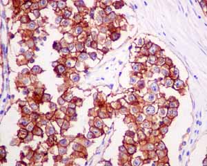 Immunohistochemistry (Formalin/PFA-fixed paraffin-embedded sections) - Anti-Placental alkaline phosphatase (PLAP) antibody [EPR6141] (ab133602), expandable thumbnail
