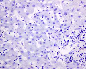Immunohistochemistry (Formalin/PFA-fixed paraffin-embedded sections) - Anti-Placental alkaline phosphatase (PLAP) antibody [EPR6141] (ab133602), expandable thumbnail