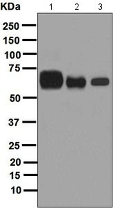 Western blot - Anti-Placental alkaline phosphatase (PLAP) antibody [EPR6141] (AB133602), expandable thumbnail