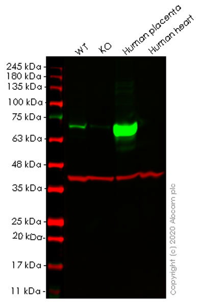 Western blot - Anti-Placental alkaline phosphatase (PLAP) antibody [EPR6141] (AB133602), expandable thumbnail