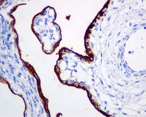 Immunohistochemistry (Formalin/PFA-fixed paraffin-embedded sections) - Anti-Placental alkaline phosphatase (PLAP) antibody [EPR6141] - BSA and Azide free (AB220315), expandable thumbnail