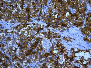 Immunohistochemistry (Formalin/PFA-fixed paraffin-embedded sections) - Anti-Placental alkaline phosphatase (PLAP) antibody [EPR6141] - BSA and Azide free (AB220315), expandable thumbnail