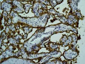 Immunohistochemistry (Formalin/PFA-fixed paraffin-embedded sections) - Anti-Placental alkaline phosphatase (PLAP) antibody [EPR6141] - BSA and Azide free (AB220315), expandable thumbnail