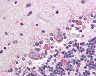 Immunohistochemistry (Formalin/PFA-fixed paraffin-embedded sections) - Anti-Placental alkaline phosphatase (PLAP) antibody [H7E8] (AB118868)