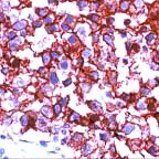 Immunohistochemistry (Formalin/PFA-fixed paraffin-embedded sections) - Anti-Placental alkaline phosphatase (PLAP) antibody [SP15] (AB16695)