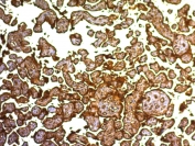 Immunohistochemistry (Formalin/PFA-fixed paraffin-embedded sections) - Anti-Placental alkaline phosphatase (PLAP) antibody [SPM593] (AB236490), expandable thumbnail