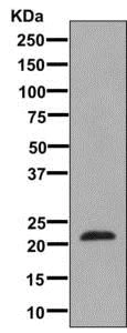 Western blot - Anti-Placental lactogen antibody [EPR8265] (AB137099)