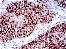 Immunohistochemistry (Formalin/PFA-fixed paraffin-embedded sections) - Anti-PLAGL1 / ZAC antibody [8D8C5] (AB181457)