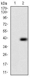 Western blot - Anti-PLAGL1 / ZAC antibody [8D8C5] (AB181457)
