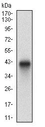 Western blot - Anti-PLAGL1 / ZAC antibody [8D8C5] (AB181457)