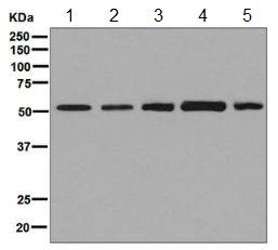 Western blot - Anti-PLAGL1 / ZAC antibody [EPR7523] (AB129063), expandable thumbnail