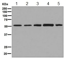 Western blot - Anti-PLAGL1 / ZAC antibody [EPR7523] - BSA and Azide free (AB248273)