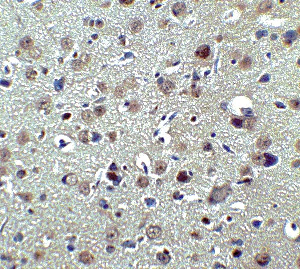 Immunohistochemistry (Formalin/PFA-fixed paraffin-embedded sections) - Anti-PLAGL2 antibody (AB139509)