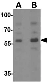 Western blot - Anti-PLAGL2 antibody (AB139509)