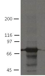 Western blot - Anti-Plakophilin 1 antibody [19F10] (AB151442)