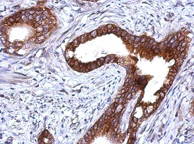Immunohistochemistry (Formalin/PFA-fixed paraffin-embedded sections) - Anti-Plakophilin 1 antibody (AB154622)