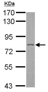 Western blot - Anti-Plakophilin 1 antibody (AB154622)