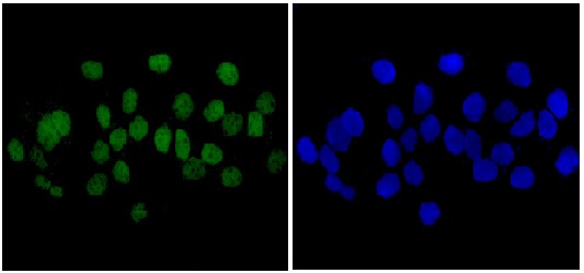 Immunocytochemistry/ Immunofluorescence - Anti-Plakophilin 1 antibody [EPR14890] (AB183512)