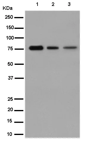 Plakophilin 1抗体[EPR14890] (ab183512)| Abcam中文官网