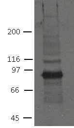 Western blot - Anti-Plakophilin 2/PKP2 antibody [8H6] (AB151402)