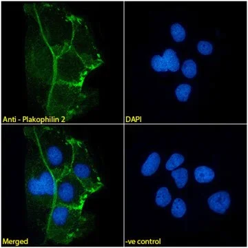 Immunocytochemistry/ Immunofluorescence - Anti-Plakophilin 2/PKP2 Antibody [8H6] - BSA and Azide free (AB316371)
