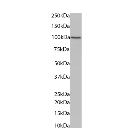 Western blot - Anti-Plakophilin 2/PKP2 Antibody [8H6] - BSA and Azide free (AB316371)