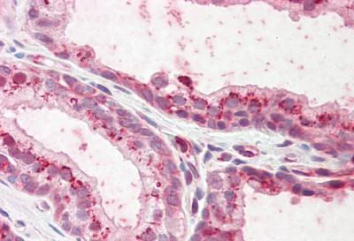 Immunohistochemistry (Formalin/PFA-fixed paraffin-embedded sections) - Anti-Plakophilin 2/PKP2 antibody (AB189323)