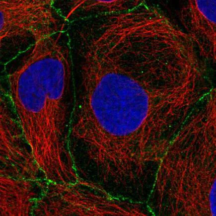 Immunocytochemistry/ Immunofluorescence - Anti-Plakophilin 2/PKP2 antibody (AB220840)