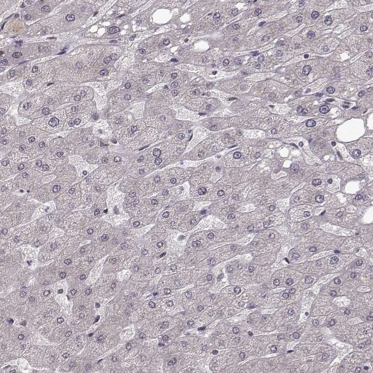 Immunohistochemistry (Formalin/PFA-fixed paraffin-embedded sections) - Anti-Plakophilin 2/PKP2 antibody (AB220840)