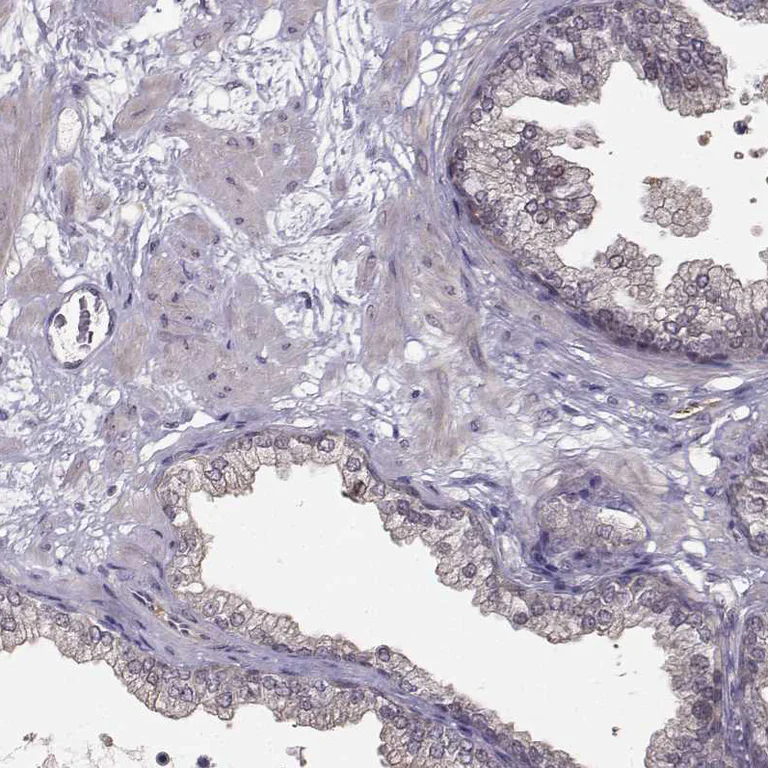 Immunohistochemistry (Formalin/PFA-fixed paraffin-embedded sections) - Anti-Plakophilin 2/PKP2 antibody (AB220840)