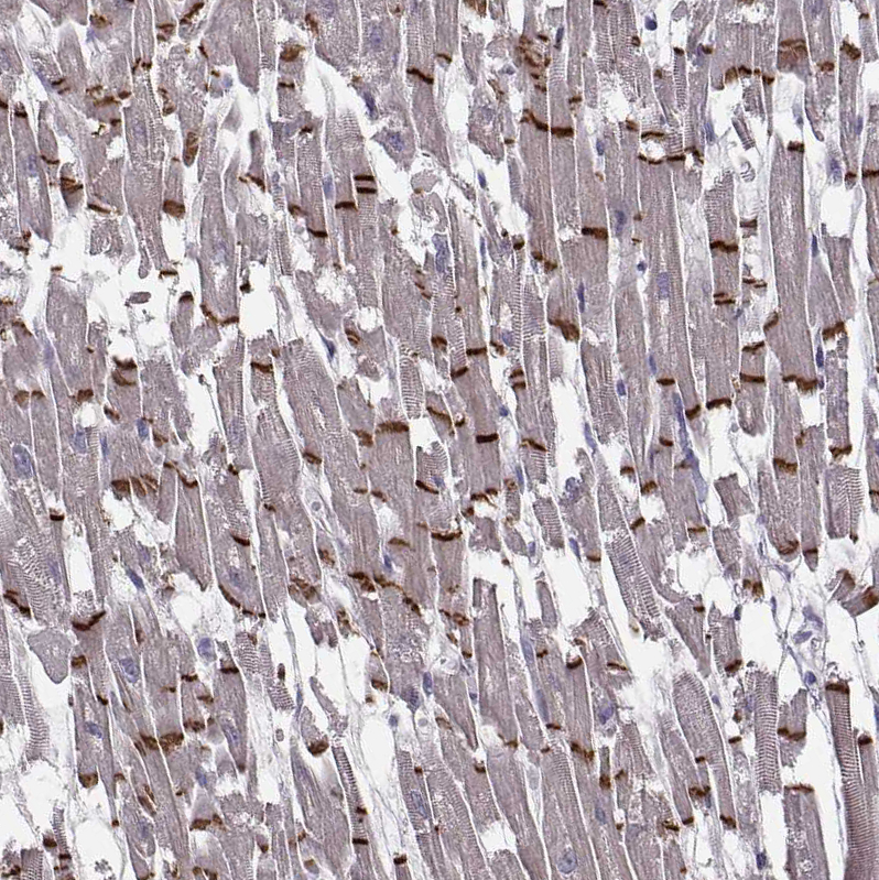 Immunohistochemistry (Formalin/PFA-fixed paraffin-embedded sections) - Anti-Plakophilin 2/PKP2 antibody (AB220840)