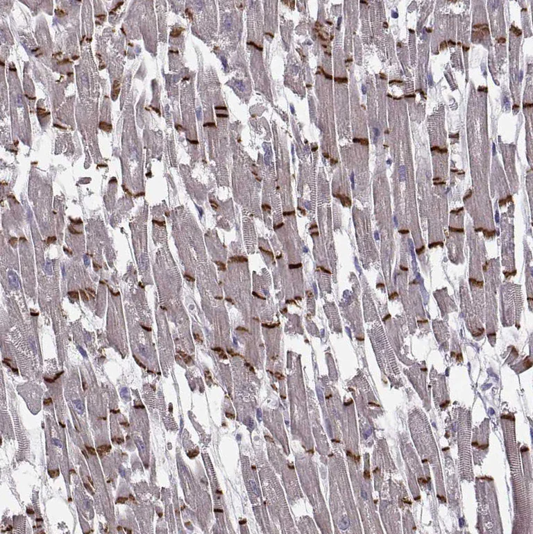 Immunohistochemistry (Formalin/PFA-fixed paraffin-embedded sections) - Anti-Plakophilin 2/PKP2 antibody (AB220840)